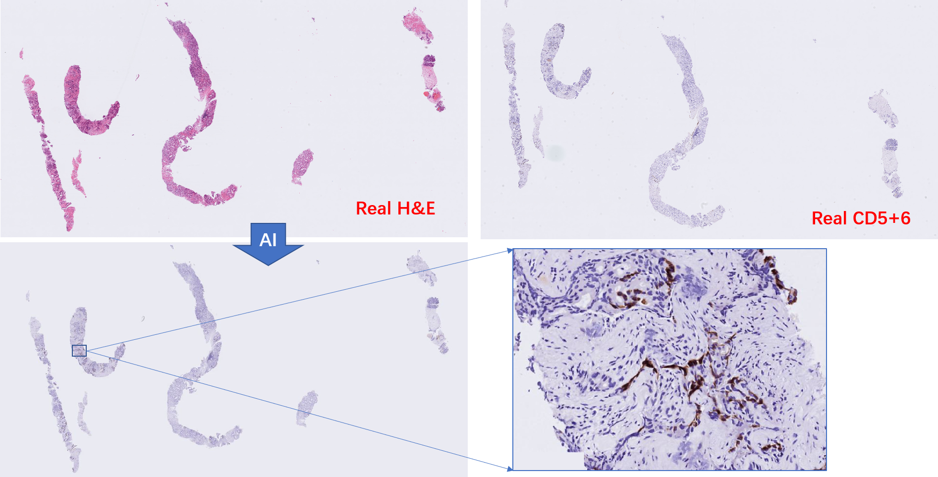 Generating virtual IHC slide from H&E slide